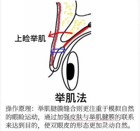 保定割双眼皮的医院哪家好？医院擅长项目种类丰富！