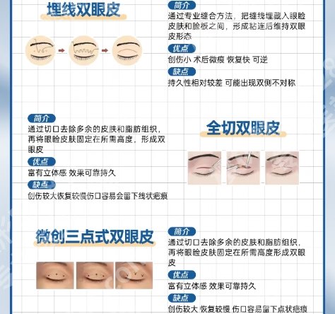 衢州割双眼皮好的医院有哪些?衢州市人民医院|中医医院等都是妥妥实力派！