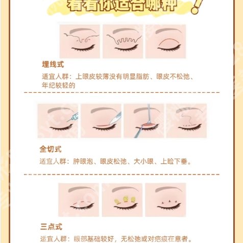 阜阳割双眼皮开眼角多少钱？一般14800元左右起！推荐几家靠谱医院！