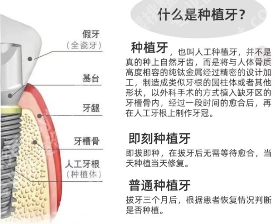 大连牙齿种植好吗？大连医科大学附属第一医院|大连市口腔等医院值得推荐！