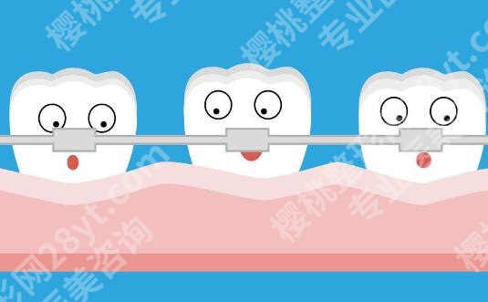 正颌和正畸的区别有哪些？速看区别在哪+适合人群分享