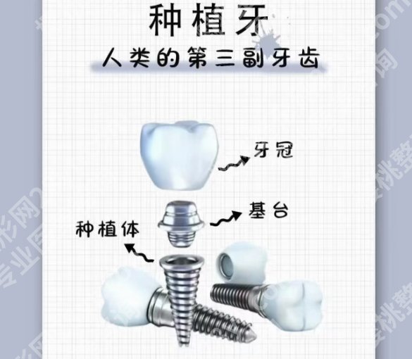 嘉兴种植牙哪个医院好？嘉兴市第一医院|第二医院等实力不容小觑！