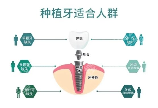 烟台牙齿种植哪家好？烟台毓璜顶医院|烟台山医院|中医医院等技术相对成熟！