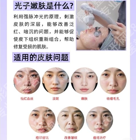 上海华山医院微针一个疗程多少钱?医院人才实力雄厚!