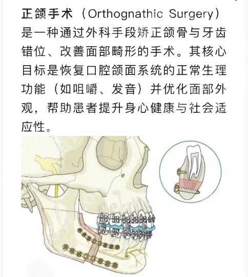 广医一附院正颌手术价格大概多少?医院实力超群!且看且珍惜