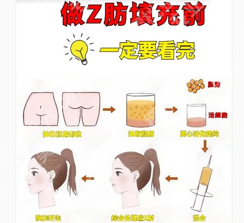 新华医院脂肪填充怎么样?新华医院有着很强的实力水平!