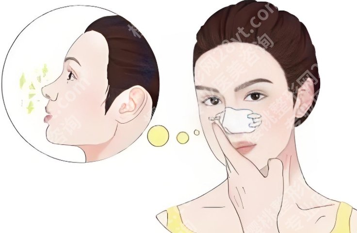 新华医院隆鼻多少钱？医院价格表参考|案例分享！