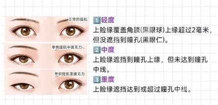 南昌二附院割双眼皮收费标准大概多少?一键查看医院简介！