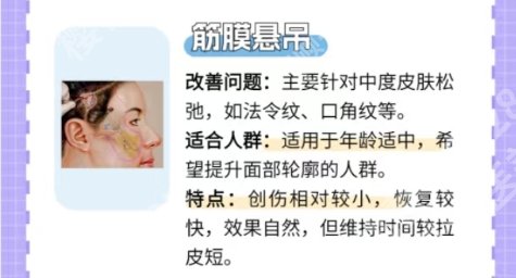 武汉同济医院筋膜悬吊怎么样？医院医生经验丰富！口碑良好
