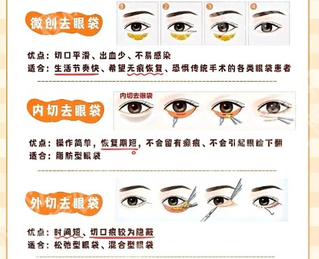 北京协和医院祛眼袋手术谁做的好？医生技术妥妥实力派！