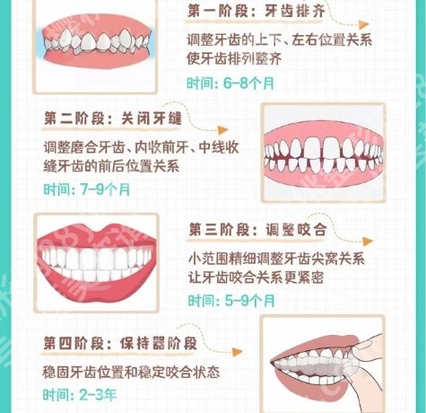 武大口腔牙齿矫正要去几次？医院项目推荐！附顾客点评