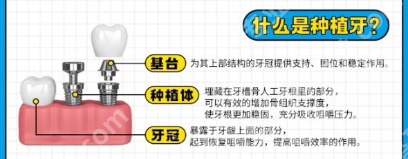 湘雅三院口腔科怎么样?医院口碑点评|明星项目等信息！收藏再看