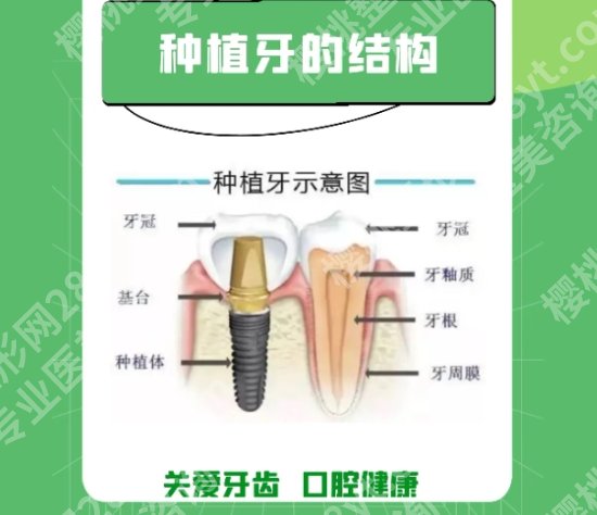 安医二附院种牙怎么样？分享了医院相关信息以及口碑！