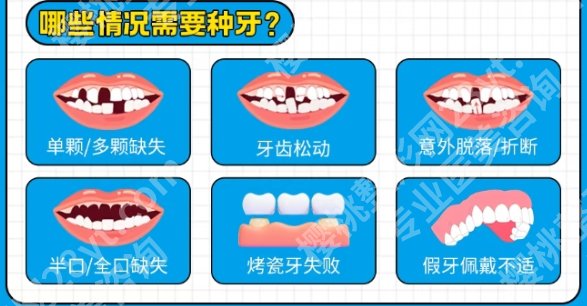 昆明市第一人民医院种植牙费用一般都是多少？基本简介就此告知！