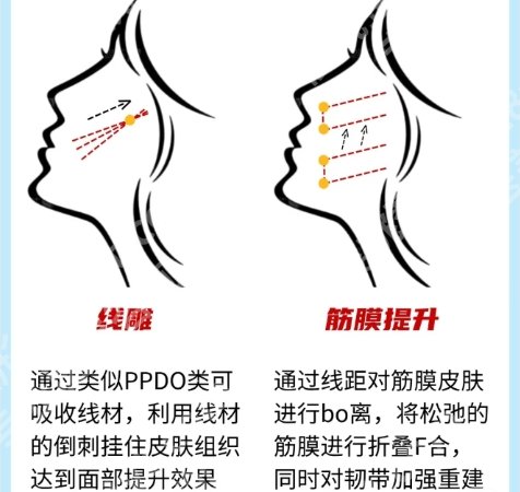 唐都医院筋膜提升术怎么样？医院技术特别有水平|项目技术也很棒！