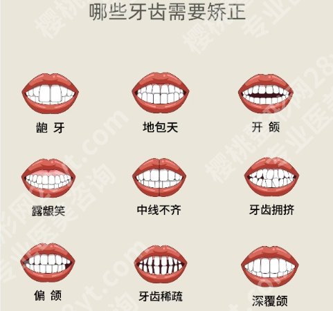 北京儿童医院牙齿矫正需要多少钱？费用一般都是7800元左右起！收藏再看