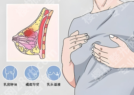 上海胸部整形医院大盘点如何?更新靠谱医院在i了