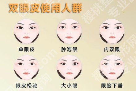 长春割双眼皮医院排名名单来了!医院技术精湛环境温馨大气!