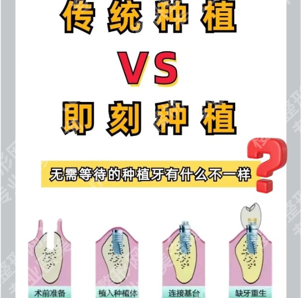 青岛牙齿种植多少钱？推荐几家技术好及性价比错的医院！
