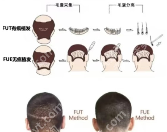 连云港植发医院哪家医技术好？2025医院排行榜名单参考！