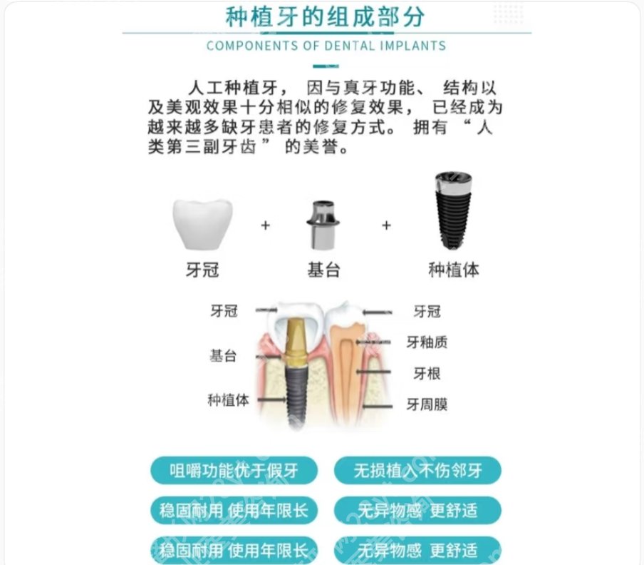 徐州牙齿种植哪家好？徐州医科大学附属医院|徐州市中心医院等技术都很精湛！