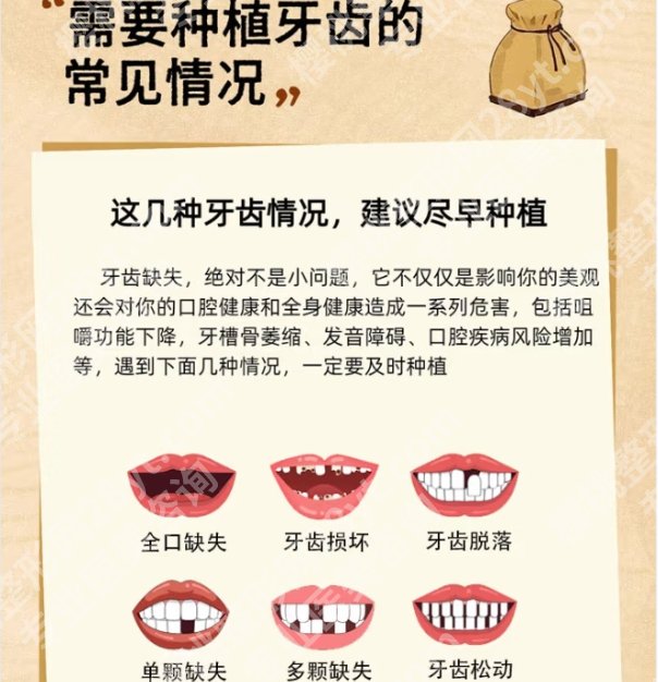 北京牙齿种植好的医生有唐志辉|吴敏节|张强等医生皆在榜上！
