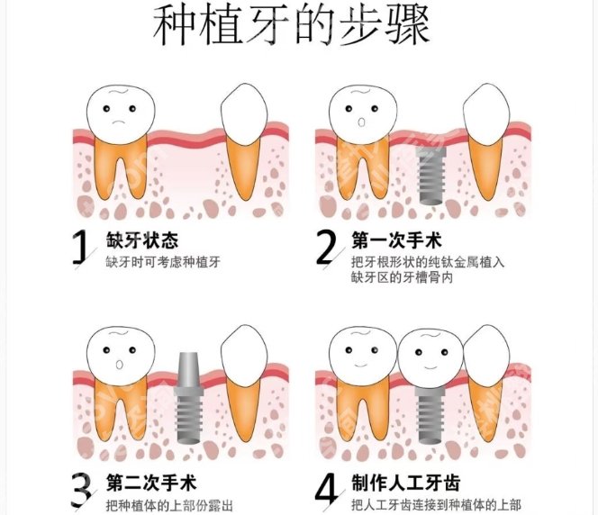 西安牙科医院排名榜10强名单揭秘！基本简介就此告知！