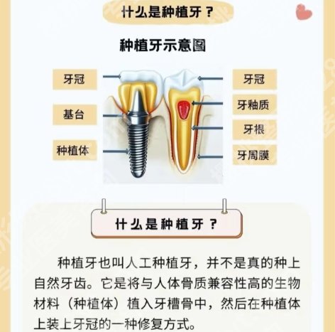牙科诊所医院哪里好？医院相关信息介绍！点击查询