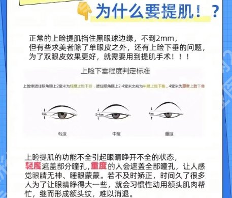 邢台割双眼皮哪里好?医院收费合理|客户反馈都很不错!