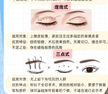 亳州割双眼皮多少钱？医院费用详情一览！速速码住