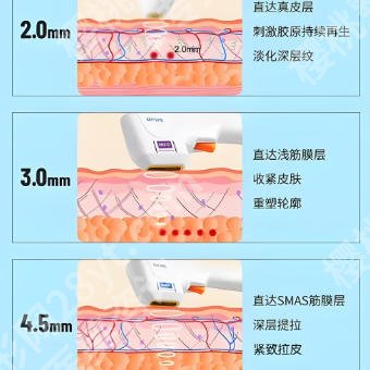 成都军大的黑钻超声炮怎么样？医院优势详情！