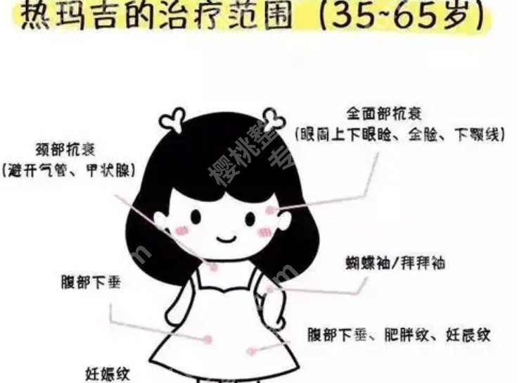 成都美莱做热玛吉怎么样？医院擅长核心项目信息！
