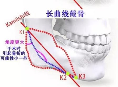 上海九院下颌角长曲线价格明细表！医院设备及技术水平详情！