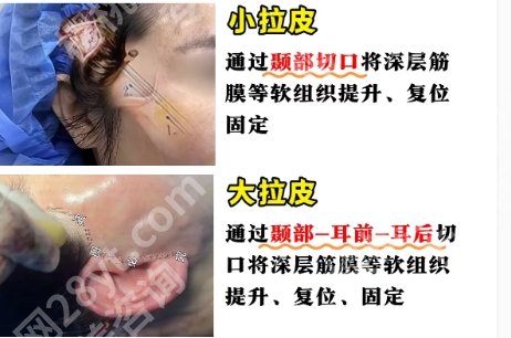 北医三院拉皮医生就很不错！医院擅长项目|医生团队资源！