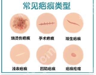 上海九院去疤痕挂什么科?医院实力不容小觑!