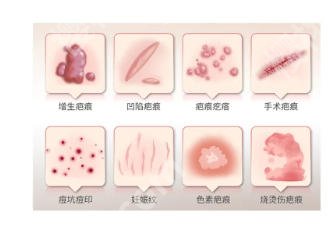 上海九院去疤痕挂什么科?医院实力不容小觑!