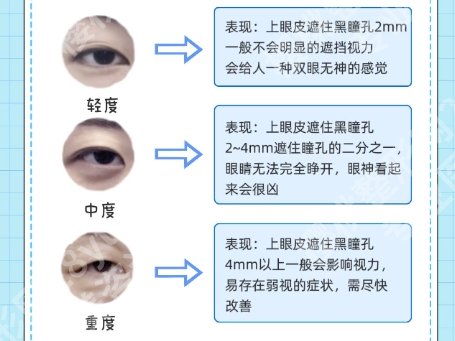 重庆军科双眼皮医生排名！医院整形项目具体介绍！