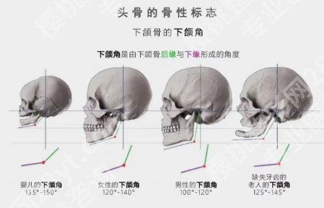吴国平磨骨怎么样？这位医生技术实力大咖!附网易反馈