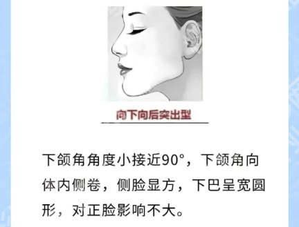 南京吴国平手术做得怎么样？医生技术精湛案例分享！