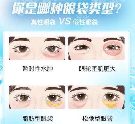 深圳北大医院眼袋手术多少钱？医院医生技术口碑双在线！