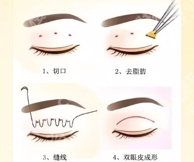浙一医院双眼皮修复专家有哪些？一键了解专家详细信息！