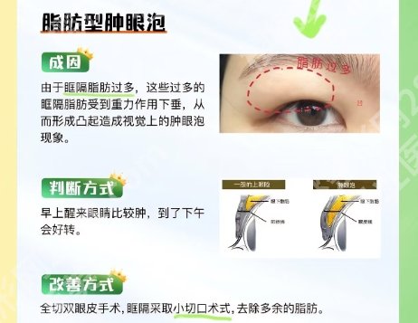 九江割双眼皮哪个医院好点?九江市第一人民医院|九江学院附属医院等都很有实力!