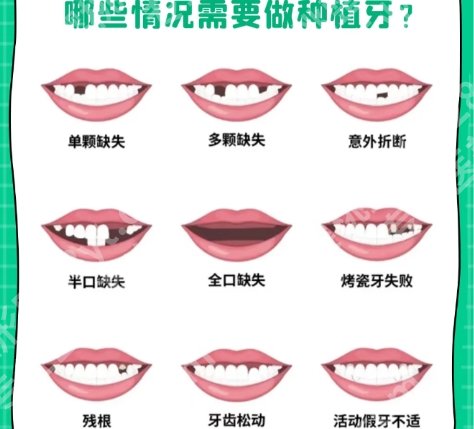 汕头牙齿种植医院排名排行榜名单揭秘！医院价目表参考！