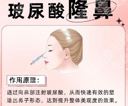成都军大玻尿酸隆鼻哪个医生好？医院价格明细表一览！