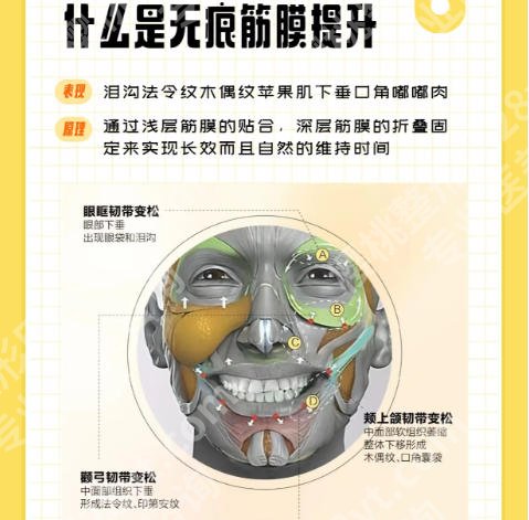 深圳美莱做无痕筋膜哪个医生做得好？医院擅长项目介绍！