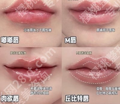 上海玻尿酸丰唇医院哪家好？五家口碑机构等你来选！