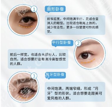 无锡卧蚕哪里做的好？排名前五名单更新！速速码住