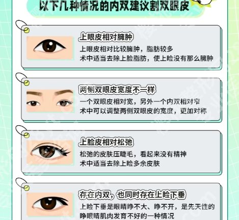 衢州割双眼皮专家排名！其中王秋明|项春|彭爱芳等医生实力都不错！
