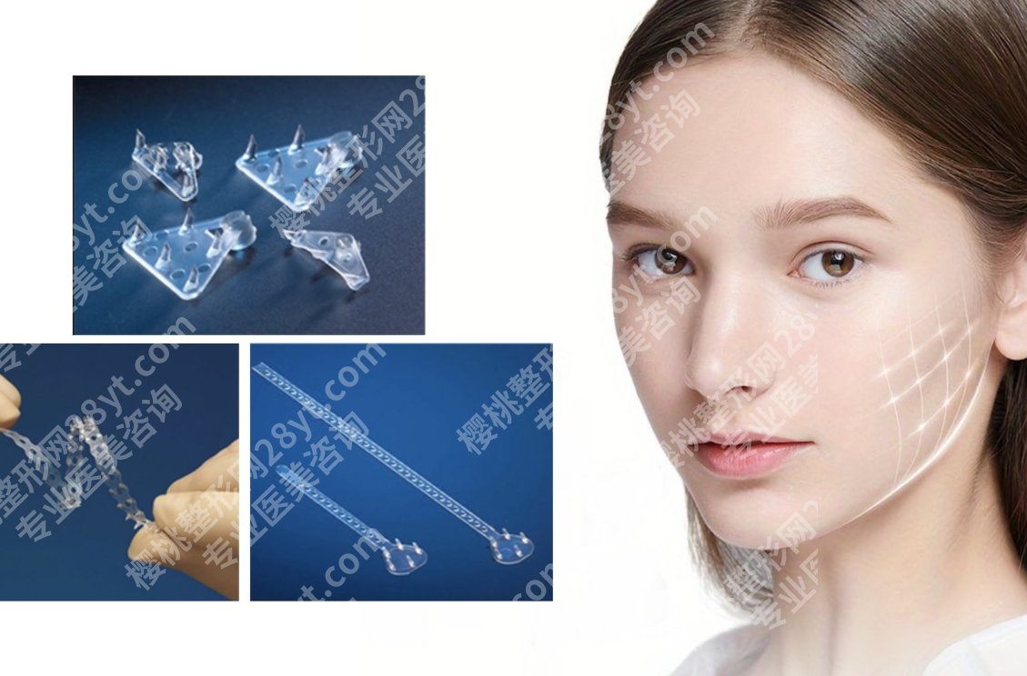筋膜提升手术价格多少？效果与预算能否两全？这里有答案