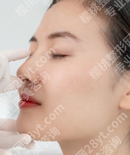 做鼻骨矫正手术什么时间做好？别被心急支配，合适的时候才有合适的结果